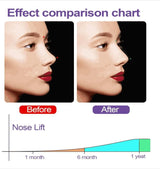 Nose Up Clip High Lifting Clipper Correction For Shaping Nose Tool